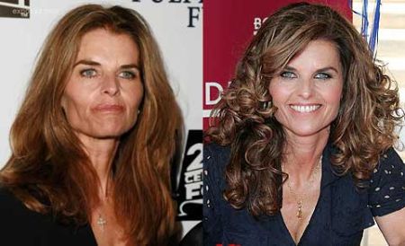 Apparently, as seen from her change in facial appearance, Maria Shriver must have undergone plastic surgery.